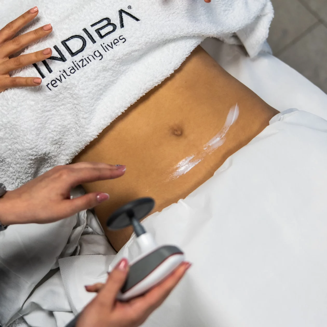 Body and Skin Clinic by EB, indiba tretmani (1)