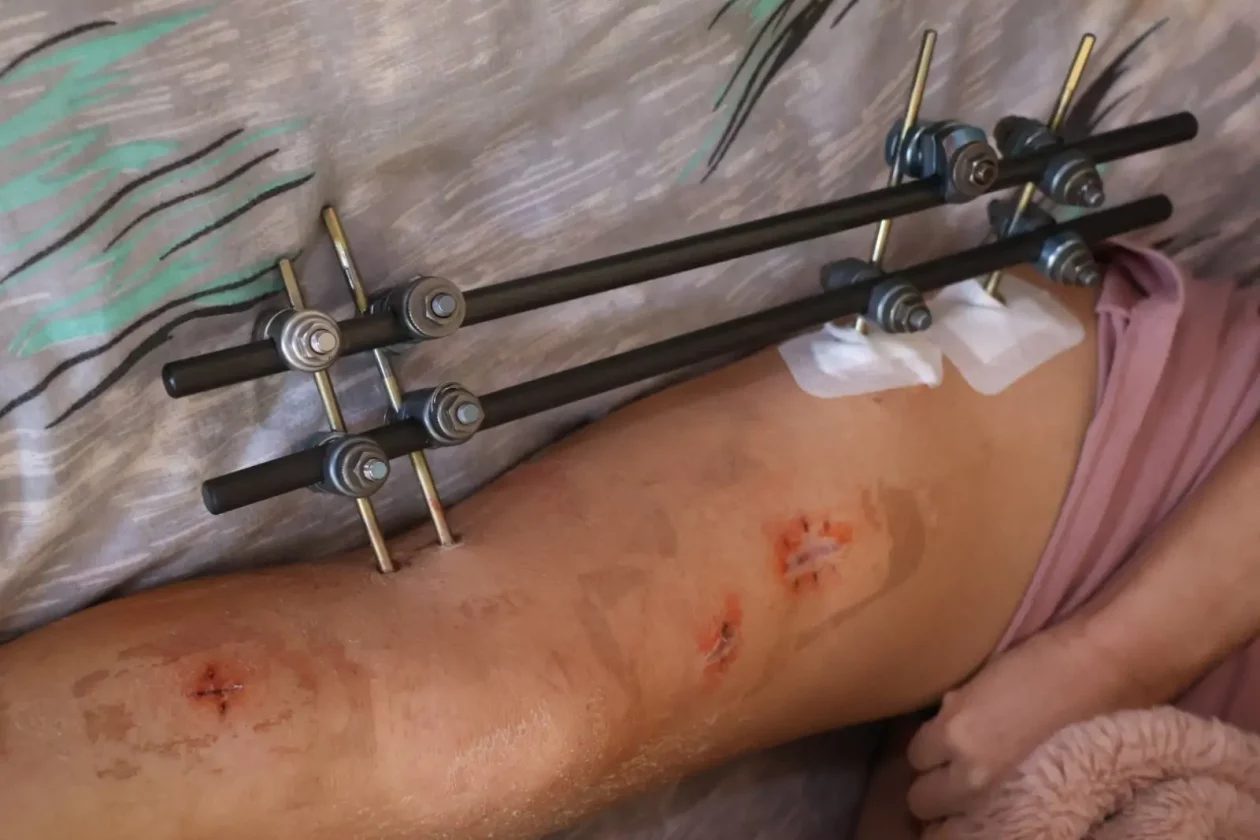 Merima Kalanjoš Sitnice 2 Merima Kalanjoš Sitnice 2