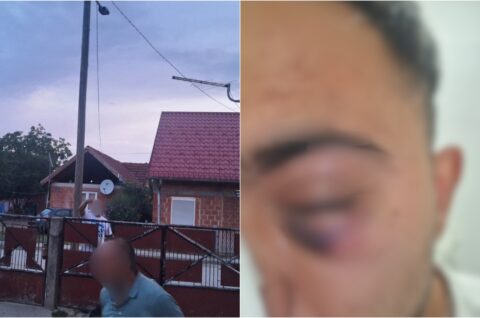 Naslovna Josip Balog napad