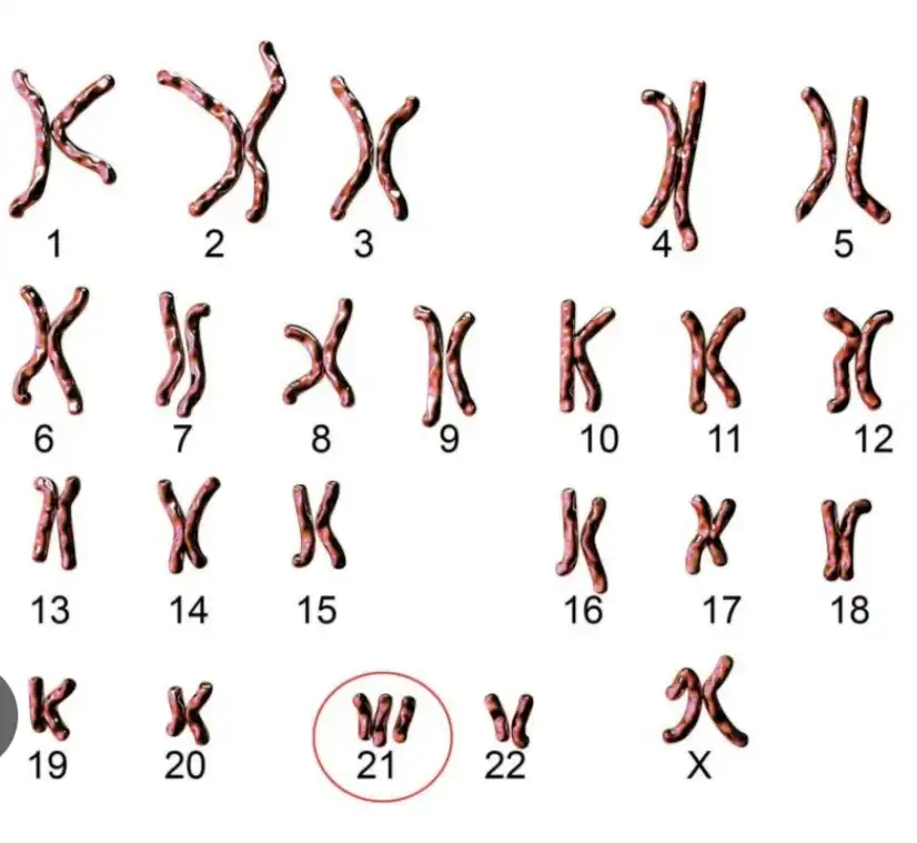 Srednja škola Čakovec obilježen Međunarodni dan osoba s Downovim sindromom (6) Srednja škola Čakovec obilježen Međunarodni dan osoba s Downovim sindromom (6)