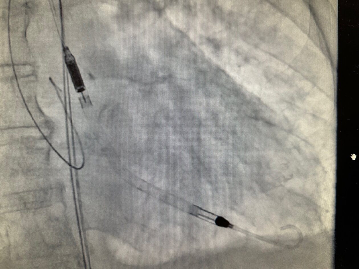 uređaj,bolnica,kardiologija (1)
