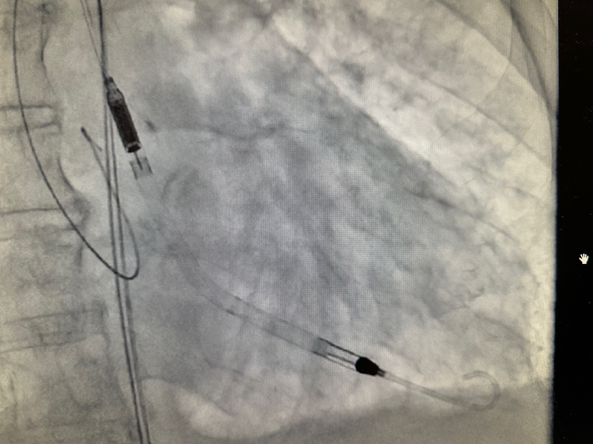 uređaj,bolnica,kardiologija (1) uređaj,bolnica,kardiologija (1)