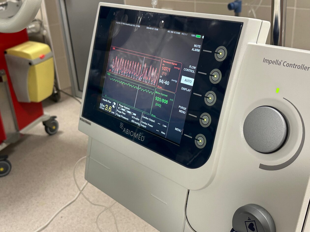 uređaj,bolnica,kardiologija (4)