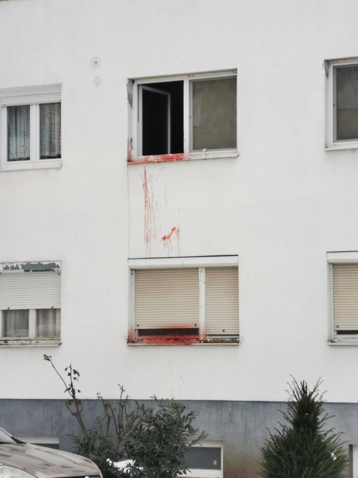 varaždin samoozlijeđivanje crna kronika pixsell varaždin samoozlijeđivanje crna kronika pixsell